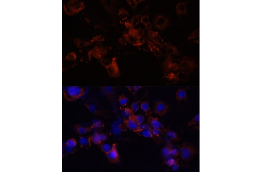 Immunofluorescence - Anti-Munc18-1 Antibody (A14751) - Antibodies.com