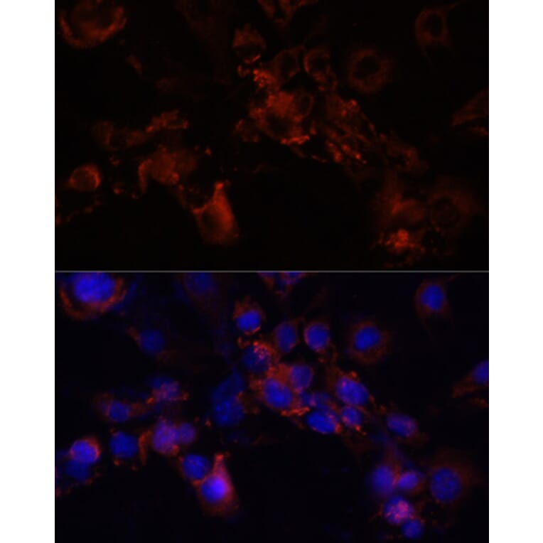 Immunofluorescence - Anti-Munc18-1 Antibody (A14751) - Antibodies.com