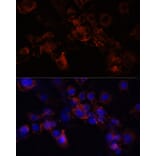 Immunofluorescence - Anti-Munc18-1 Antibody (A14751) - Antibodies.com