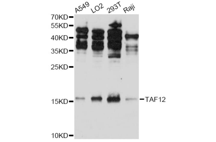 Western Blot - Anti-TAF12 Antibody (A5421) - Antibodies.com
