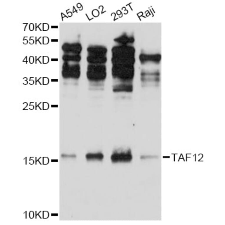 Western Blot - Anti-TAF12 Antibody (A5421) - Antibodies.com