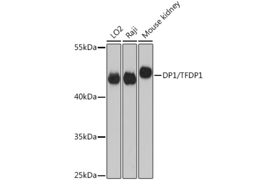 Western Blot - Anti-DP1 Antibody (A14753) - Antibodies.com