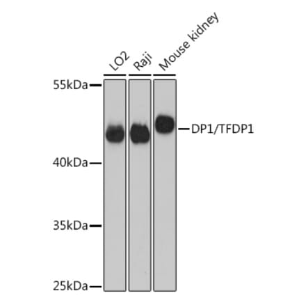 Western Blot - Anti-DP1 Antibody (A14753) - Antibodies.com