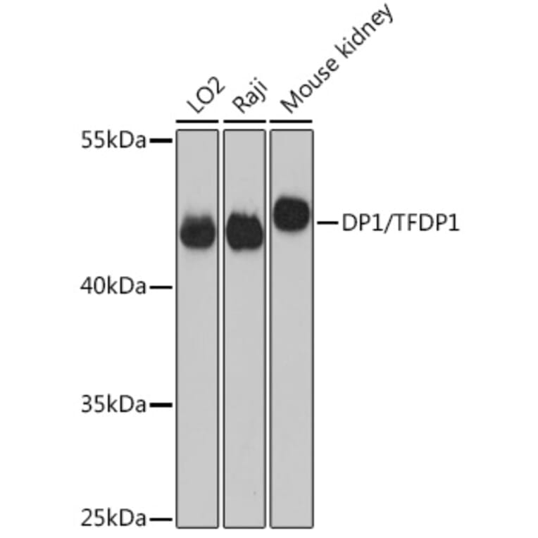 Western Blot - Anti-DP1 Antibody (A14753) - Antibodies.com