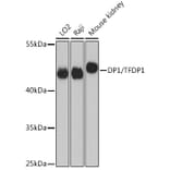 Western Blot - Anti-DP1 Antibody (A14753) - Antibodies.com