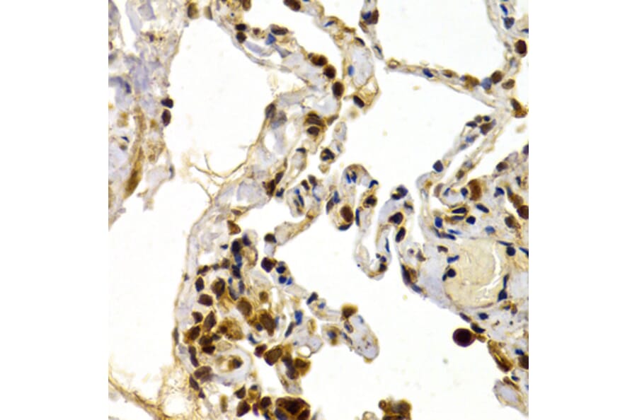 Immunohistochemistry - Anti-DP1 Antibody (A14753) - Antibodies.com