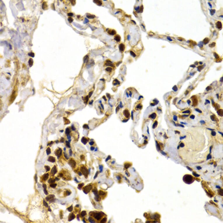 Immunohistochemistry - Anti-DP1 Antibody (A14753) - Antibodies.com