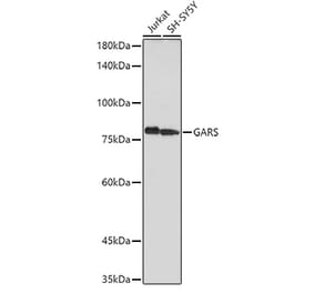 Western Blot - Anti-GARS Antibody (A14755) - Antibodies.com