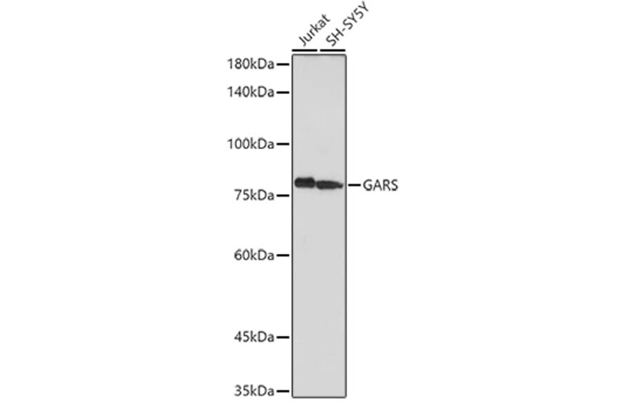Western Blot - Anti-GARS Antibody (A14755) - Antibodies.com