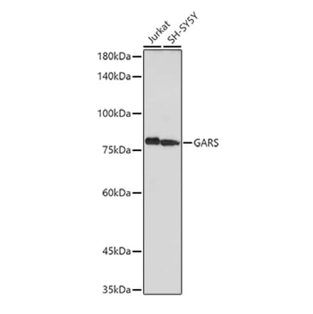 Western Blot - Anti-GARS Antibody (A14755) - Antibodies.com
