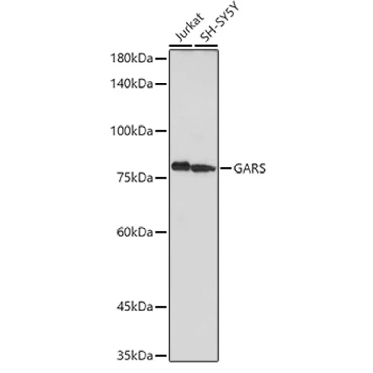 Western Blot - Anti-GARS Antibody (A14755) - Antibodies.com