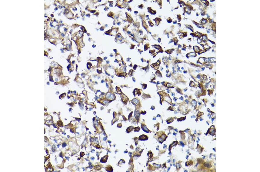Immunohistochemistry - Anti-GARS Antibody (A14755) - Antibodies.com