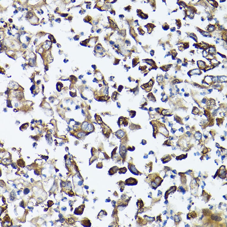 Immunohistochemistry - Anti-GARS Antibody (A14755) - Antibodies.com