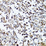 Immunohistochemistry - Anti-GARS Antibody (A14755) - Antibodies.com