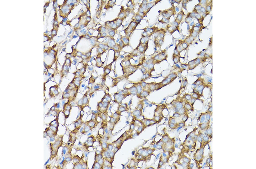 Immunohistochemistry - Anti-GARS Antibody (A14755) - Antibodies.com