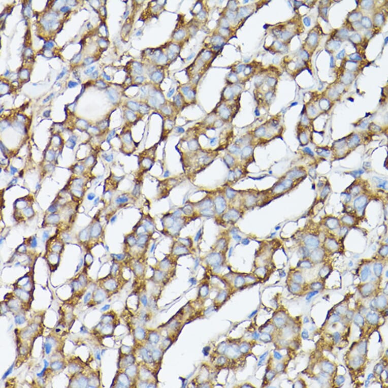 Immunohistochemistry - Anti-GARS Antibody (A14755) - Antibodies.com