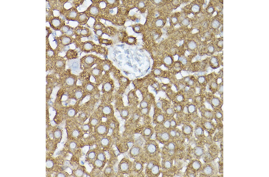 Immunohistochemistry - Anti-GARS Antibody (A14755) - Antibodies.com