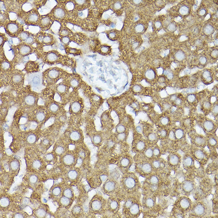 Immunohistochemistry - Anti-GARS Antibody (A14755) - Antibodies.com