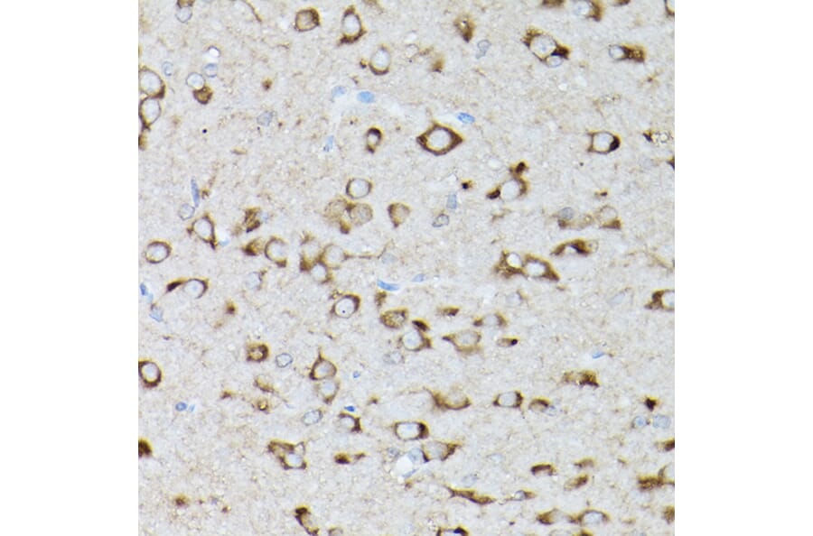 Immunohistochemistry - Anti-GARS Antibody (A14755) - Antibodies.com