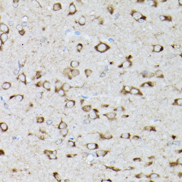 Immunohistochemistry - Anti-GARS Antibody (A14755) - Antibodies.com