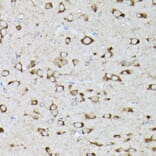 Immunohistochemistry - Anti-GARS Antibody (A14755) - Antibodies.com