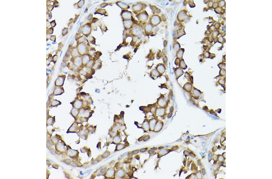 Immunohistochemistry - Anti-GARS Antibody (A14755) - Antibodies.com