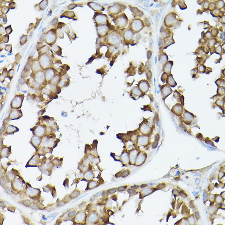 Immunohistochemistry - Anti-GARS Antibody (A14755) - Antibodies.com