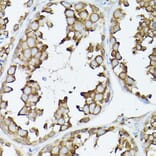 Immunohistochemistry - Anti-GARS Antibody (A14755) - Antibodies.com