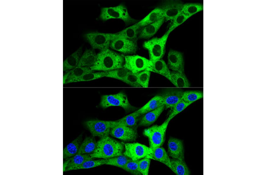 Immunofluorescence - Anti-GARS Antibody (A14755) - Antibodies.com