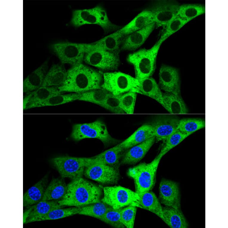 Immunofluorescence - Anti-GARS Antibody (A14755) - Antibodies.com