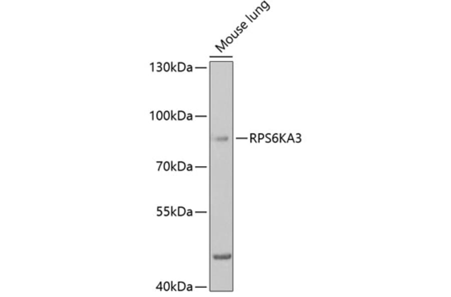 Western Blot - Anti-Rsk 2/MAPKAP Kinase 1b Antibody (A14756) - Antibodies.com