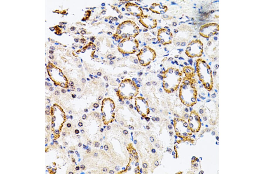 Immunohistochemistry - Anti-Rsk 2/MAPKAP Kinase 1b Antibody (A14756) - Antibodies.com