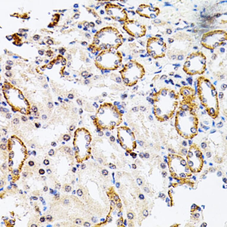 Immunohistochemistry - Anti-Rsk 2/MAPKAP Kinase 1b Antibody (A14756) - Antibodies.com