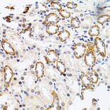 Immunohistochemistry - Anti-Rsk 2/MAPKAP Kinase 1b Antibody (A14756) - Antibodies.com