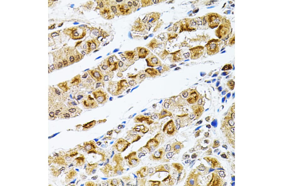 Immunohistochemistry - Anti-Rsk 2/MAPKAP Kinase 1b Antibody (A14756) - Antibodies.com