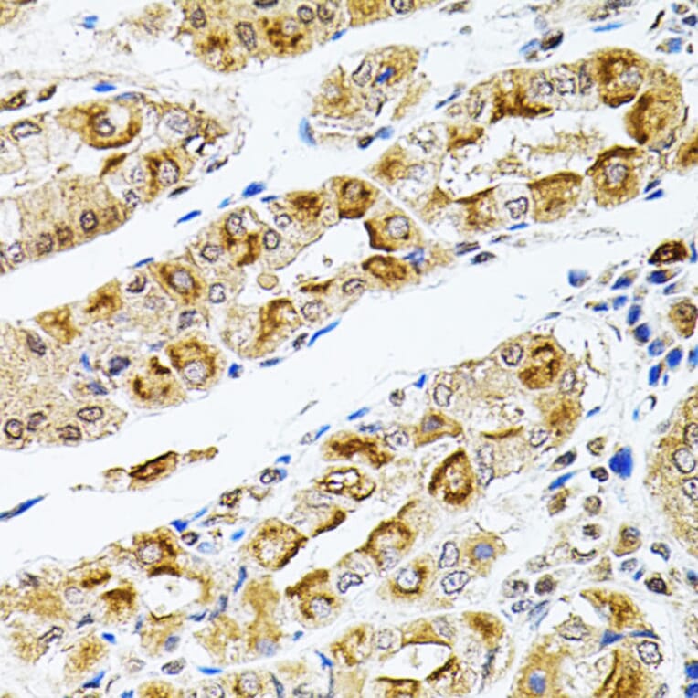 Immunohistochemistry - Anti-Rsk 2/MAPKAP Kinase 1b Antibody (A14756) - Antibodies.com