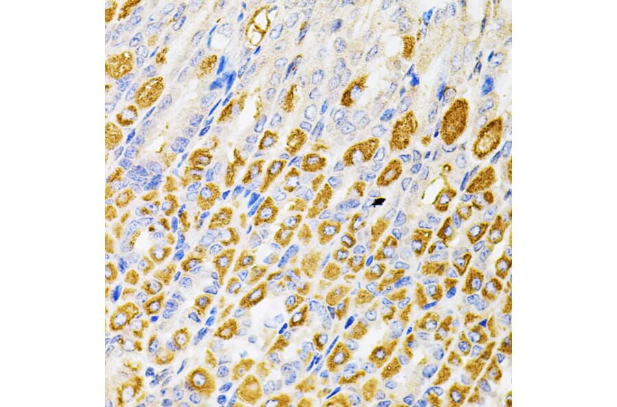Immunohistochemistry - Anti-Rsk 2/MAPKAP Kinase 1b Antibody (A14756) - Antibodies.com