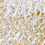 Immunohistochemistry - Anti-Rsk 2/MAPKAP Kinase 1b Antibody (A14756) - Antibodies.com