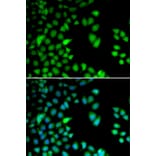 Immunofluorescence - Anti-Rsk 2/MAPKAP Kinase 1b Antibody (A14756) - Antibodies.com