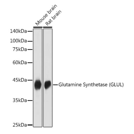Western Blot - Anti-Glutamine Synthetase Antibody (A14757) - Antibodies.com