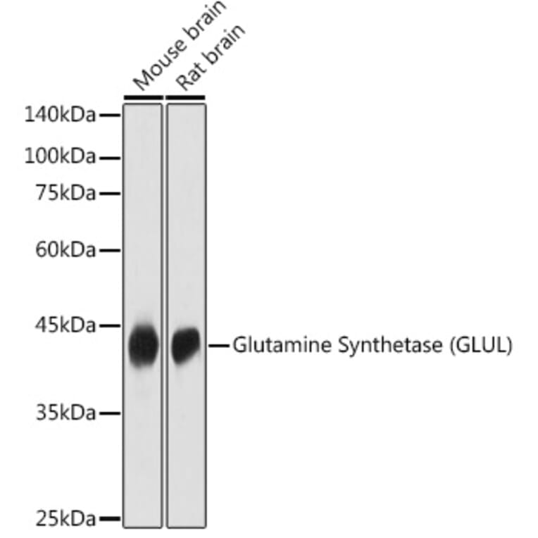 Western Blot - Anti-Glutamine Synthetase Antibody (A14757) - Antibodies.com
