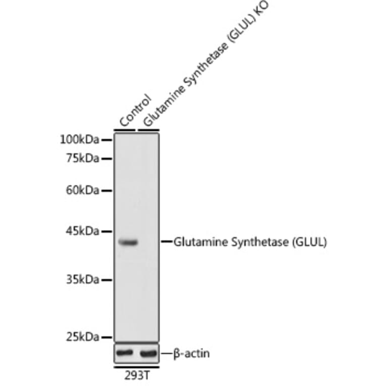 Western Blot - Anti-Glutamine Synthetase Antibody (A14757) - Antibodies.com