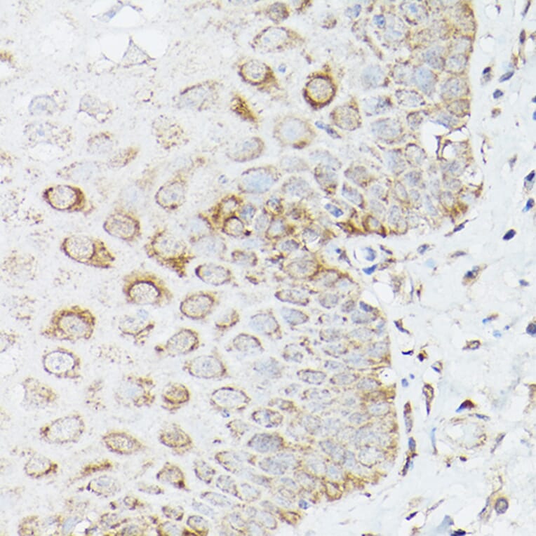 Immunohistochemistry - Anti-Glutamine Synthetase Antibody (A14757) - Antibodies.com
