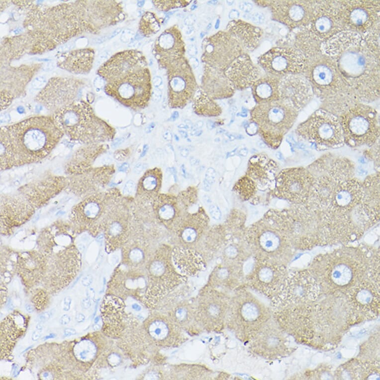 Immunohistochemistry - Anti-Glutamine Synthetase Antibody (A14757) - Antibodies.com