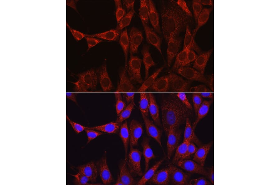 Immunofluorescence - Anti-Glutamine Synthetase Antibody (A14757) - Antibodies.com