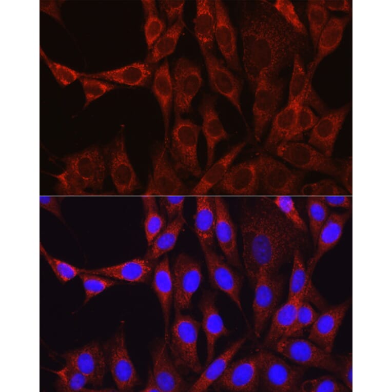 Immunofluorescence - Anti-Glutamine Synthetase Antibody (A14757) - Antibodies.com