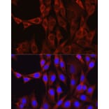 Immunofluorescence - Anti-Glutamine Synthetase Antibody (A14757) - Antibodies.com