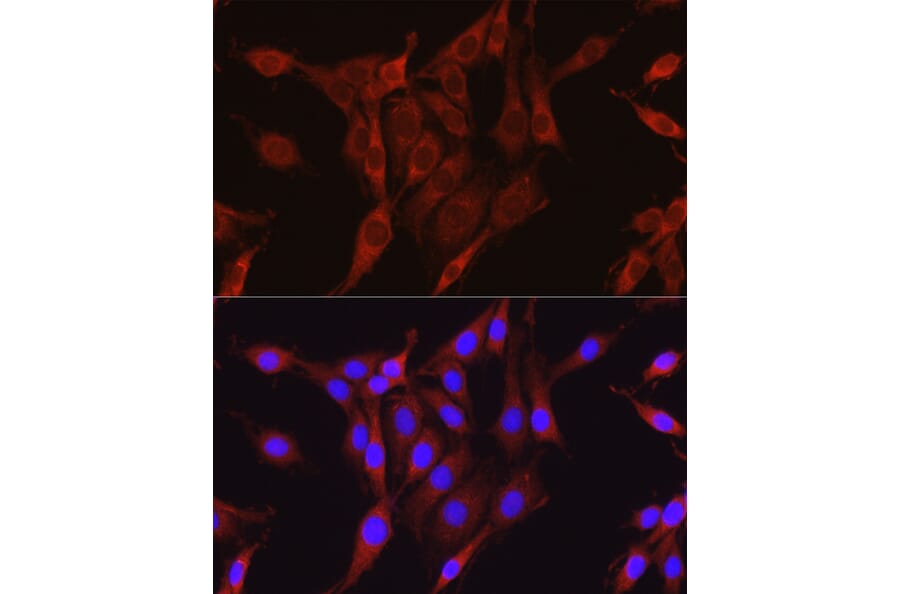 Immunofluorescence - Anti-Glutamine Synthetase Antibody (A14757) - Antibodies.com