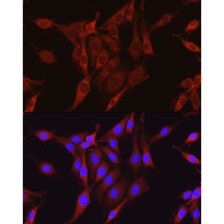 Immunofluorescence - Anti-Glutamine Synthetase Antibody (A14757) - Antibodies.com