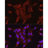 Immunofluorescence - Anti-Glutamine Synthetase Antibody (A14757) - Antibodies.com